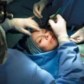 What You Need to Know Before Going Under Cosmetic Surgery