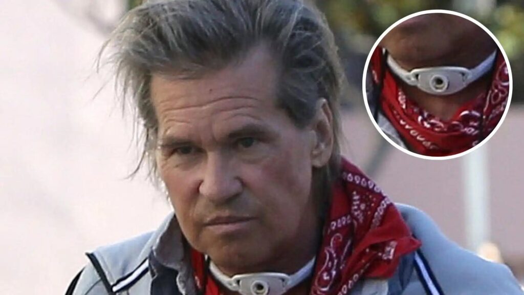 Val Kilmer wearing a Trachea device.
