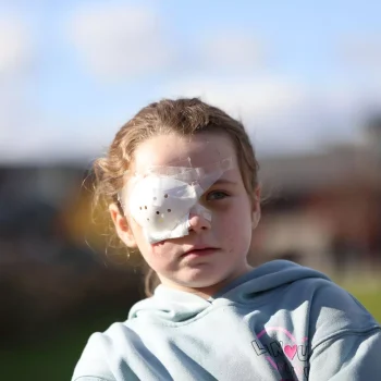 Ruby Grainger loses eye in vape explosion